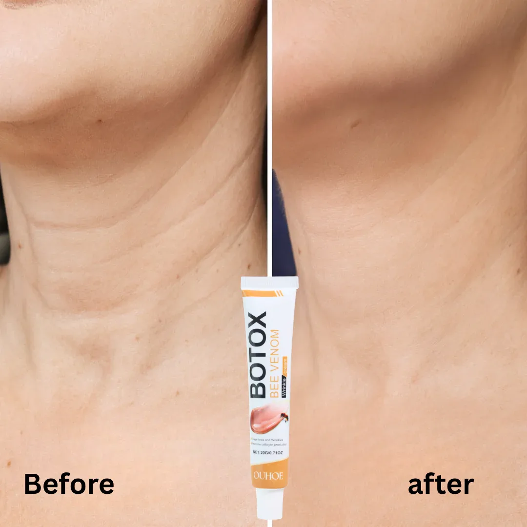 Крем против бръчки с пчелна отрова BOTOX Bee Venom, 20 g
