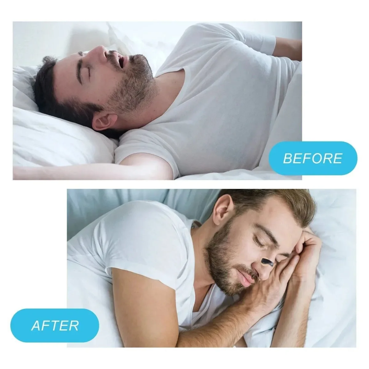 Магнитен назален разширител Premier Nasal Dilator